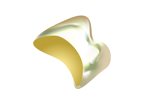 ラミネートべニア