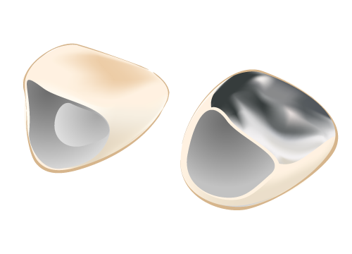 ゴールドクラウン